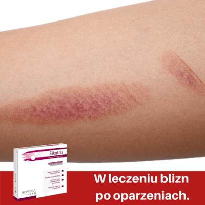 SIKATRIS plaster w rozmiarze 1x 10cm x 10cm -